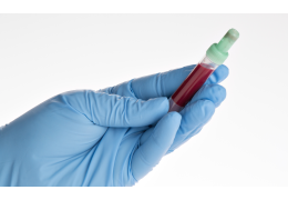 Anémie : les causes et remèdes naturels